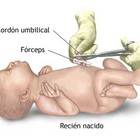 Investigadores del HUSC Hospital demuestran que retrasar el corte del cordón umbilical mejoran el desarrollo del bebé