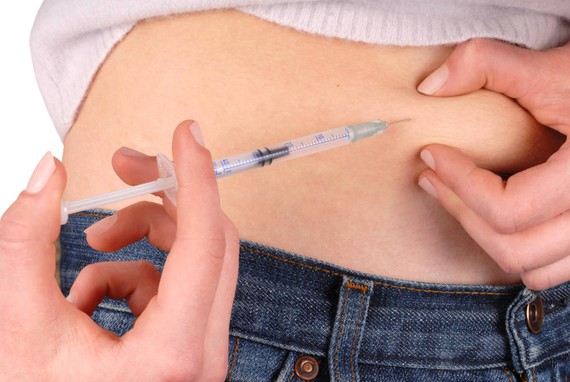 La bomba de insulina es más eficaz que las inyecciones para controlar el azúcar en la sangre