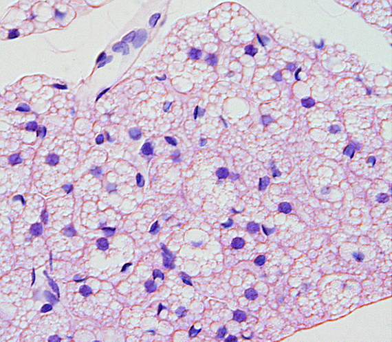 Científicos del ibs.GRANADA identifican genes que pueden suponer un avance en el tratamiento de la obesidad