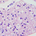 Científicos del ibs.GRANADA identifican genes que pueden suponer un avance en el tratamiento de la obesidad