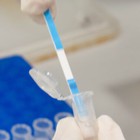 Cómo conseguir muestras de enfermos de Covid-19 para trabajar en el laboratorio: Las empresas se citan con los hospitales de Granada