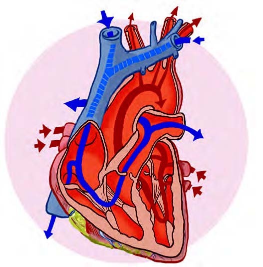 La administración de hierro mejora el tratamiento de la insuficiencia cardiaca