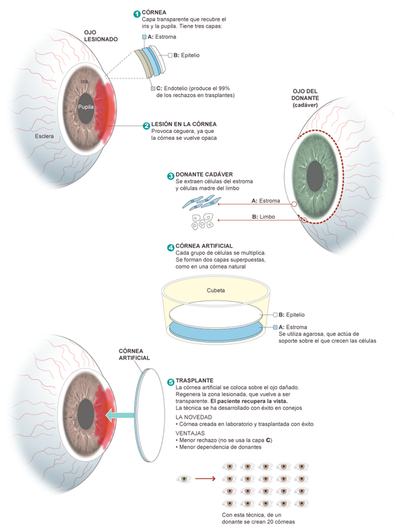 Granada inicia un ensayo clínico para fabricar córneas artificiales