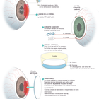 Granada inicia un ensayo clínico para fabricar córneas artificiales