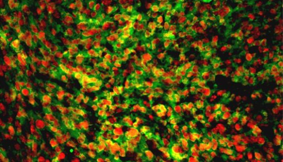 Aprueban el primer ensayo clínico del mundo usando células pluripotentes inducidas