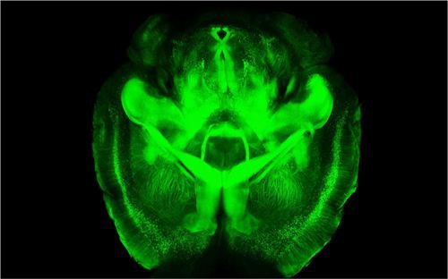 Detectan actividad cerebral en el coma profundo asociado con encefalograma plano