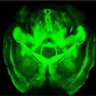 Detectan actividad cerebral en el coma profundo asociado con encefalograma plano