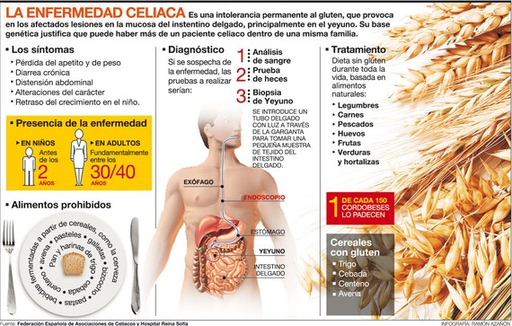 Novedades sobre la enfermedad celiaca