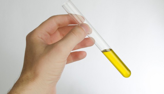 Una endocrinóloga del Hospital de Jaén premiada por un estudio sobre los beneficios del consumo de aceite de oliva