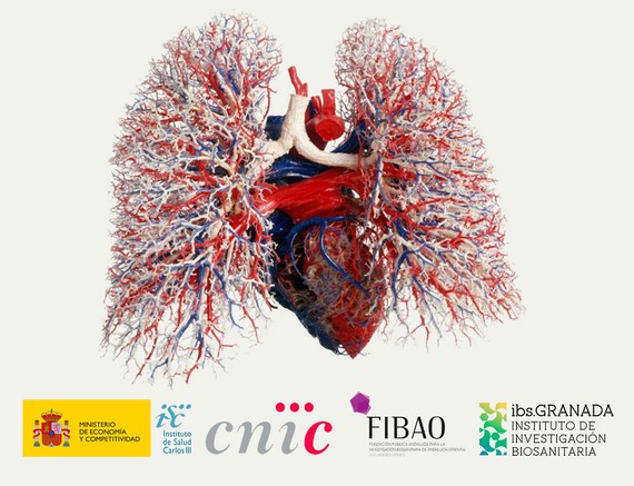 FIBAO y el CENTRO NACIONAL DE INVESTIGACIONES CARDIOVASCULARES CARLOS III (F.S.P.) firman un acuerdo que permitirá una potenciación de las lineas comunes de investigación