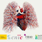 FIBAO y el CENTRO NACIONAL DE INVESTIGACIONES CARDIOVASCULARES CARLOS III (F.S.P.) firman un acuerdo que permitirá una potenciación de las lineas comunes de investigación