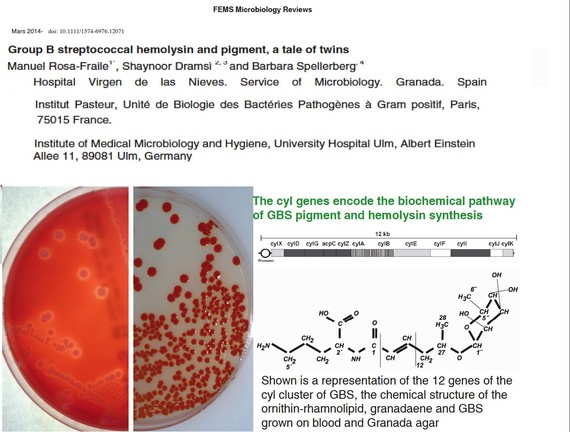 Microbiólogos del HVN clarifican la virulencia del estreptococo de grupo B en recién nacidos