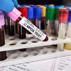 Un estudio del ibs.GRANADA evalúa un ensayo automatizado para la detección del virus de la viruela del mono