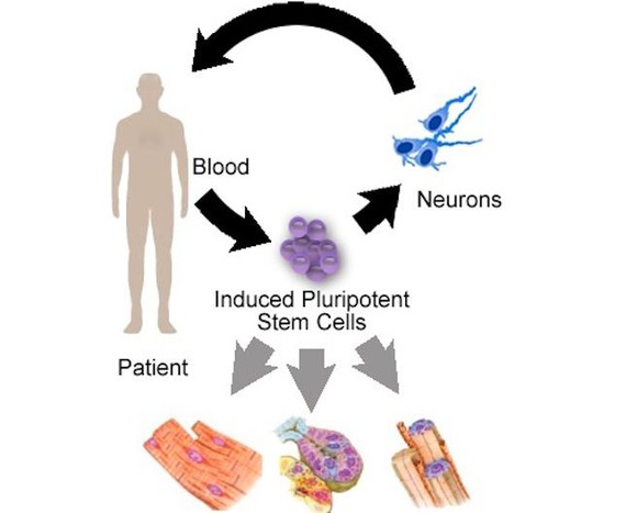 Identifican cómo las mutaciones genéticas matan las células cerebrales en el Parkinson