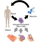 Identifican cómo las mutaciones genéticas matan las células cerebrales en el Parkinson