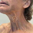 Investigadores del ibs.GRANADA descubren factores clave en la disfagia de supervivientes de cáncer de cabeza y cuello