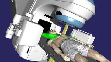 Diseñada una nueva fórmula para calcular los efectos de la radioterapia