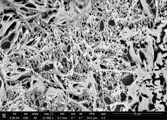 Investigadores del ibs.GRANADA desarrollan un protocolo que puede suponer un avance en la regeneración ósea