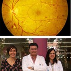 Un ensayo europeo utiliza por primera vez un colirio contra la retinopatía diabética