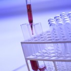Andalucía intensifica la investigación clínica en busca de tratamientos contra el Covid-19