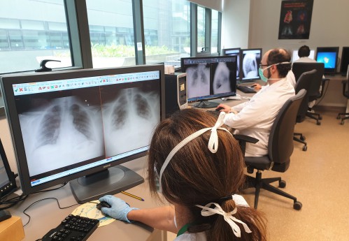 El Hospital Universitario Clínico San Cecilio junto con la Universidad de Granada trabajan en el desarrollo de un modelo de inteligencia artificial capaz de determinar si un paciente tiene coronavirus leyendo su radiografía de tórax 