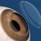 Una nueva técnica corrige la miopía sin levantar la superficie de la córnea