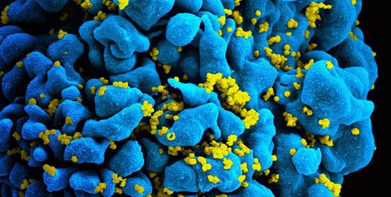 Una investigación de la UGR podría contribuir a diseñar futuras vacunas contra el VIH