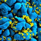 Rastrean por primera vez la batalla entre el VIH y un sistema inmunitario capaz de defenderse