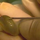 Obtienen huesos artificiales a partir de células madre procedentes de cordón umbilical