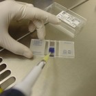 Avanzan en la identificación de los efectos antitumorales de la melatonina