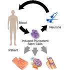 Identifican cómo las mutaciones genéticas matan las células cerebrales en el Parkinson