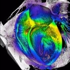 Desarrollan un gel inyectable estimula la regeneración del corazón tras un infarto